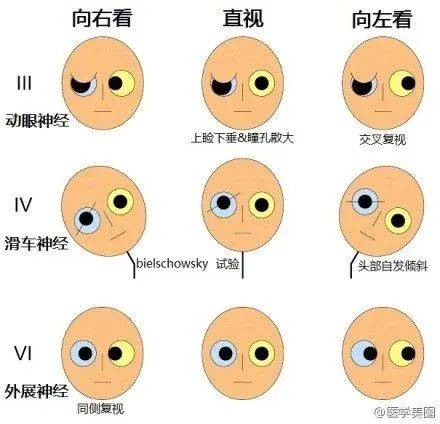 神经系统速记口诀及超全图谱