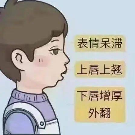 孩子睡觉打鼾,张口呼吸.越长越丑?警惕"腺样体肥大"在作祟!