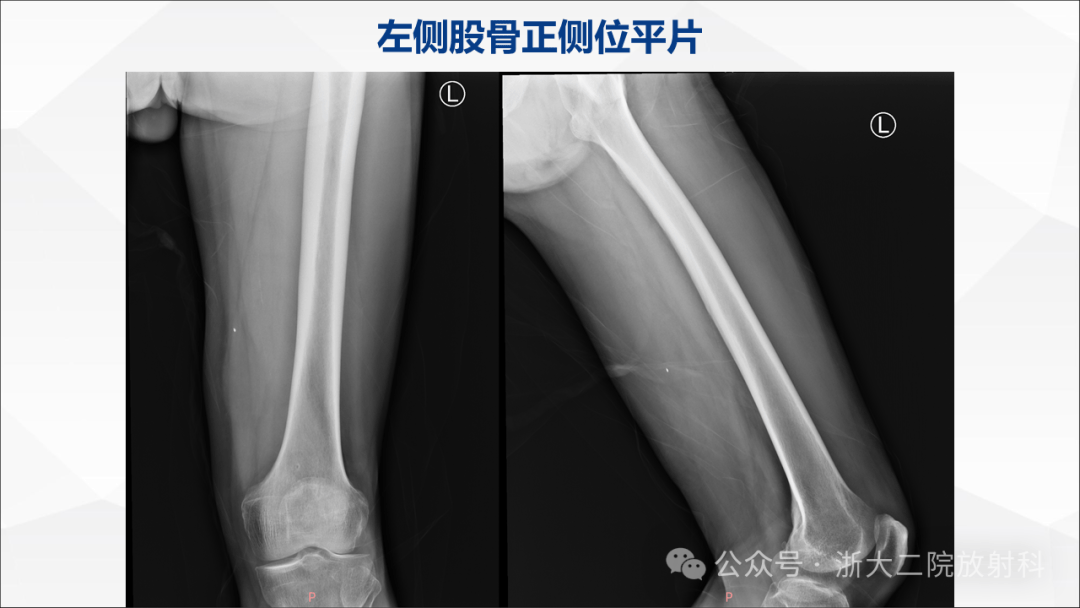 浙大二院放射科读片会(第七十四期)