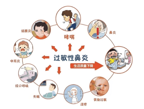 【汤医科普】宝宝过敏性鼻炎的常见问题