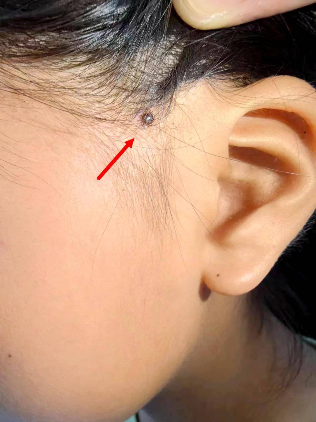 商丘一地蜱虫较多,园林绿化部门回复了