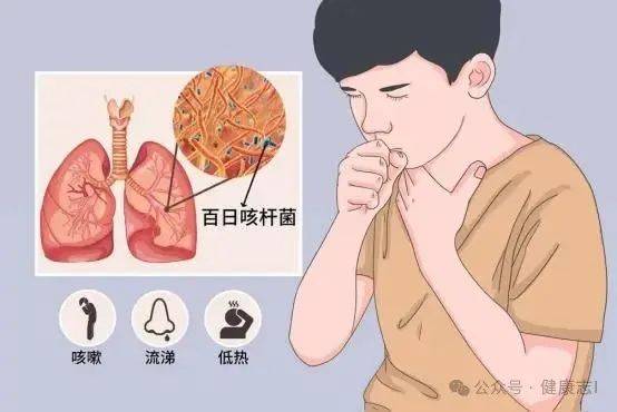 痰是肺的“报警器”?白痰、绿痰、黄痰、黑痰,分别代表了什么?_呼吸道_肺部_症状