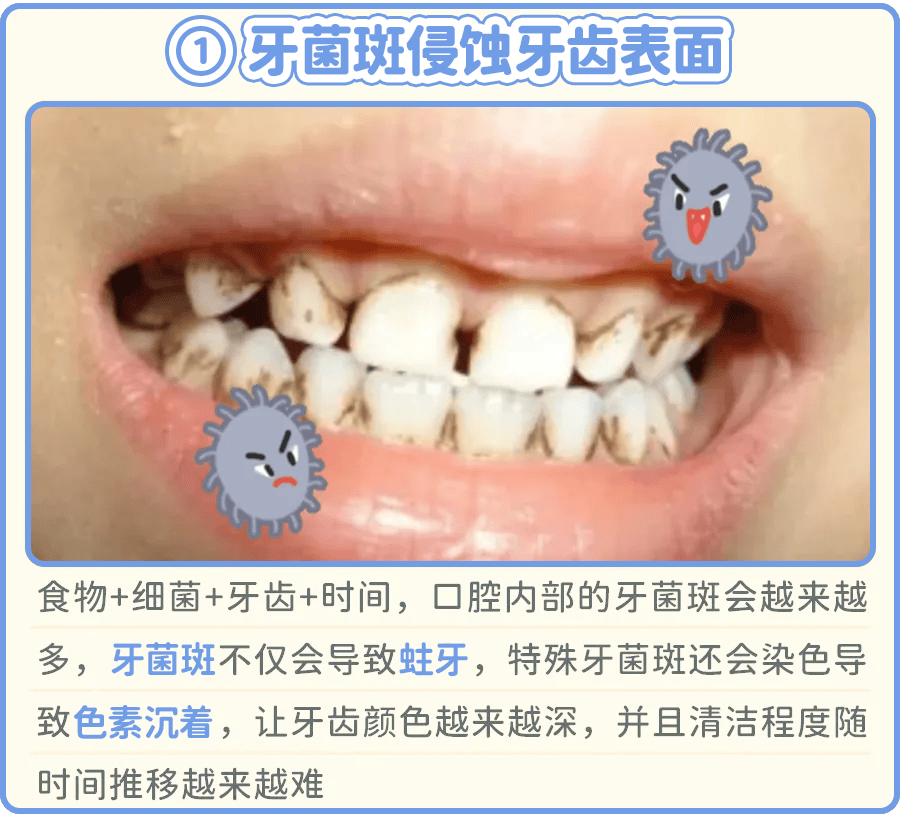 有时候是因为吃多了高色素的食物,色素会沉积在牙齿表面;或者是油脂