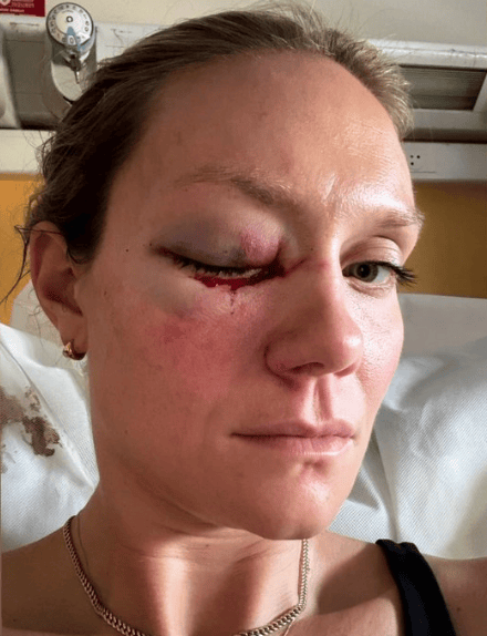 突发!美国女排2名队员出车祸 撞电线杆 美国男排霍尔特发文震惊