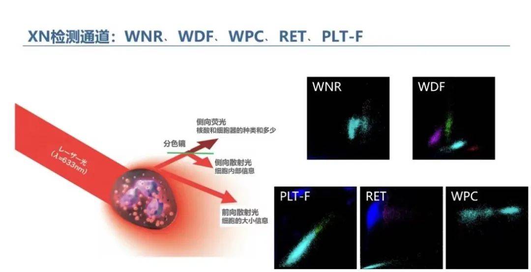 血常规直方图与散点图图片