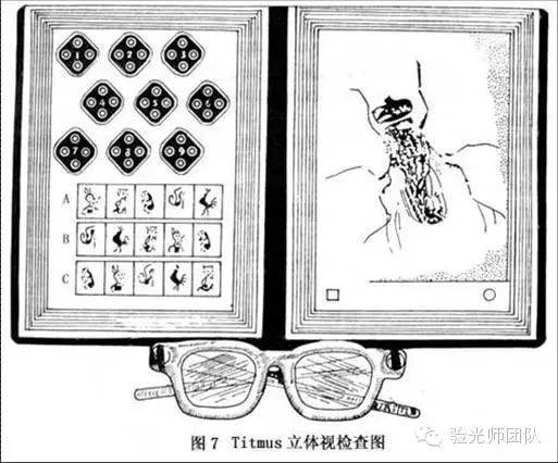 双眼视觉_检查_功能_视网膜