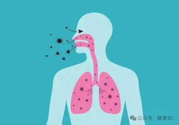 痰是肺的“报警器”?白痰、绿痰、黄痰、黑痰,分别代表了什么?_呼吸道_肺部_症状