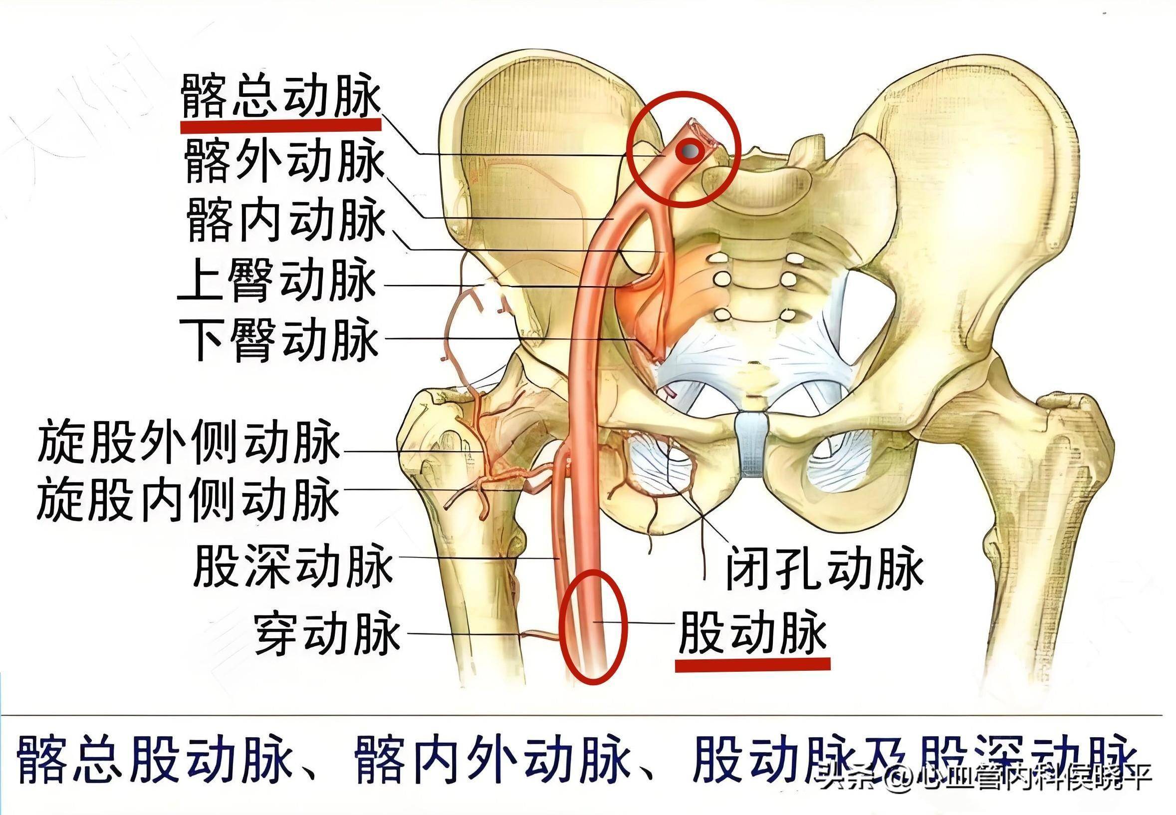 哪儿的血管堵了?