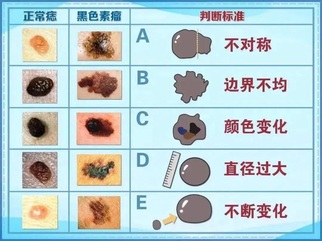 耳鼻咽喉科扫"黑"除"恶"