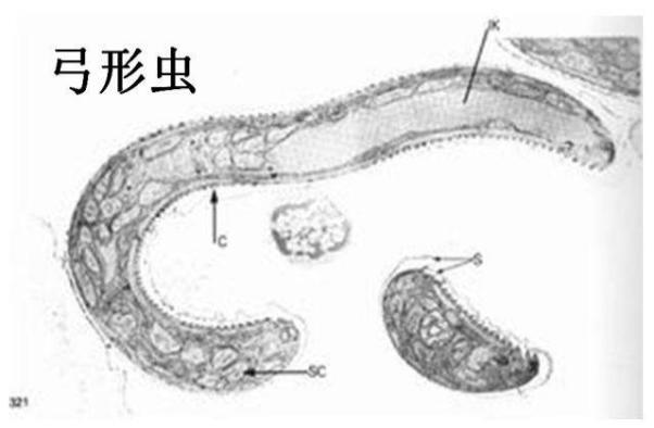 弓形虫多大图片