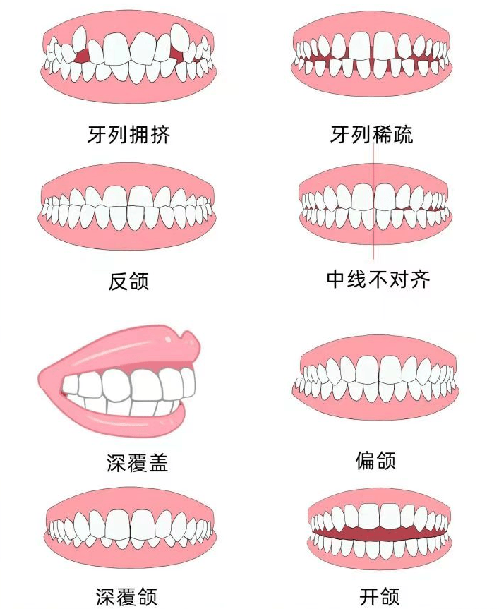 正确的咀嚼方法图解图片