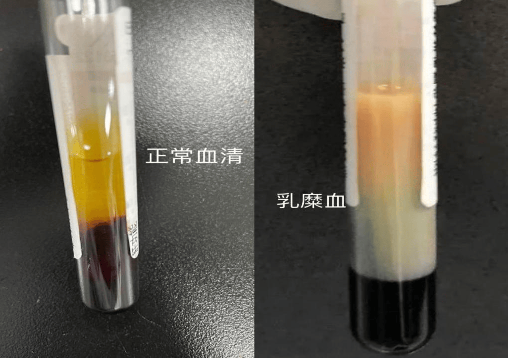 空腹抽血您做对了吗