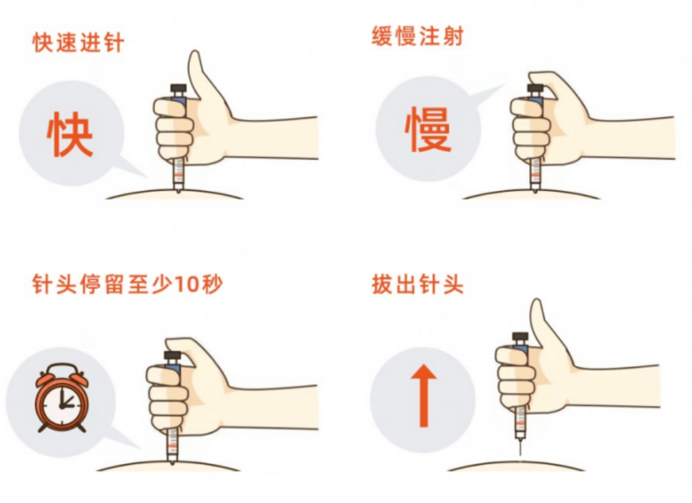 预充式注射器使用方法图片