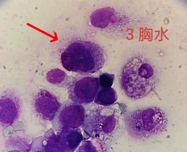 【图谱】看图识细胞(第136期)_形态学_颗粒_特征