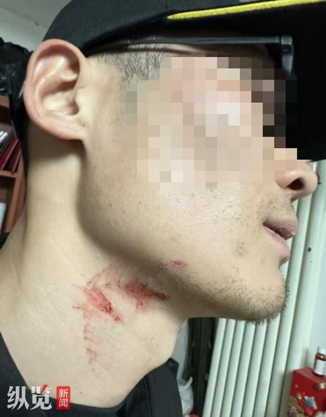 菏泽南站一主播直播时被打？派出所称出警情况不便透露，街道办：菏泽南站禁止直播，如发现会劝导