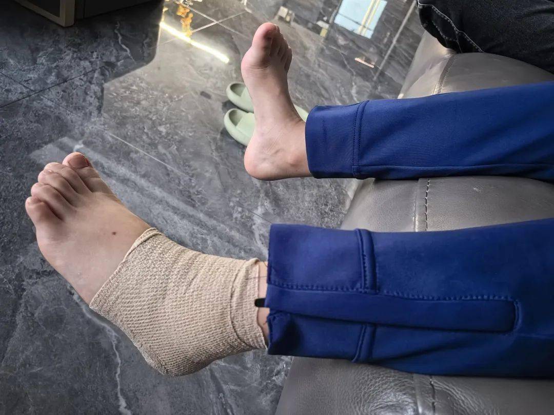 孩子扭伤后,我为什么不拍片?