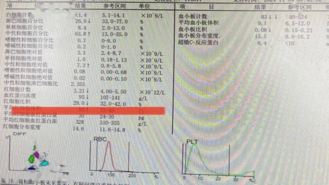 验血报告单图片女孩图片