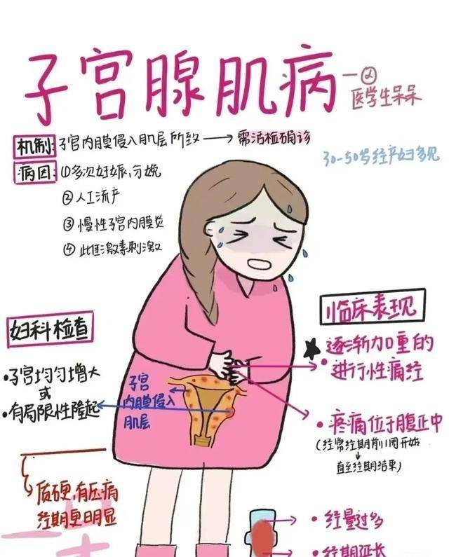 子宫腺肌症是怎么得的图片