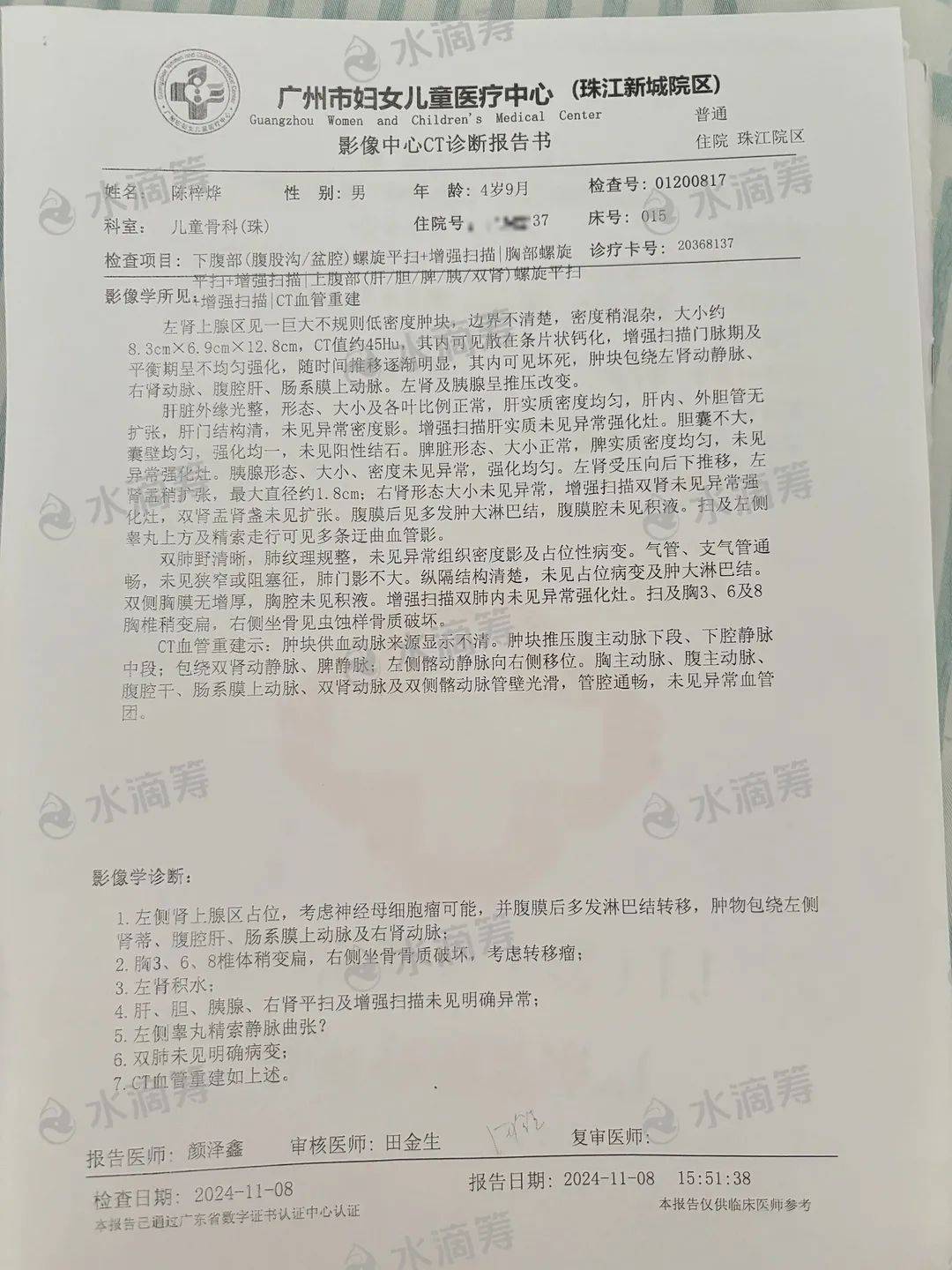 潮阳4岁幼童罹患"肿瘤之王"!_孩子_检查_治疗