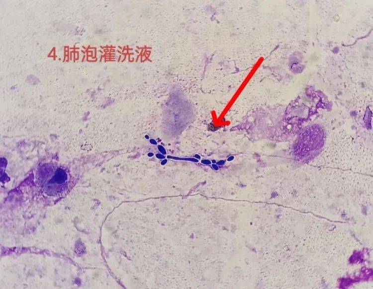看图识细胞(第137期)
