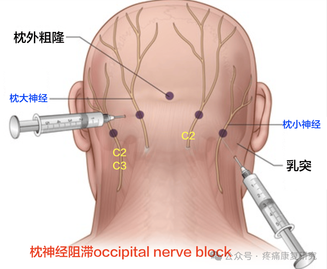 枕部在哪个位置图片图片