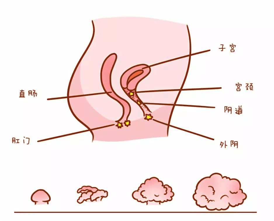 艾滋病女性下体症状图片