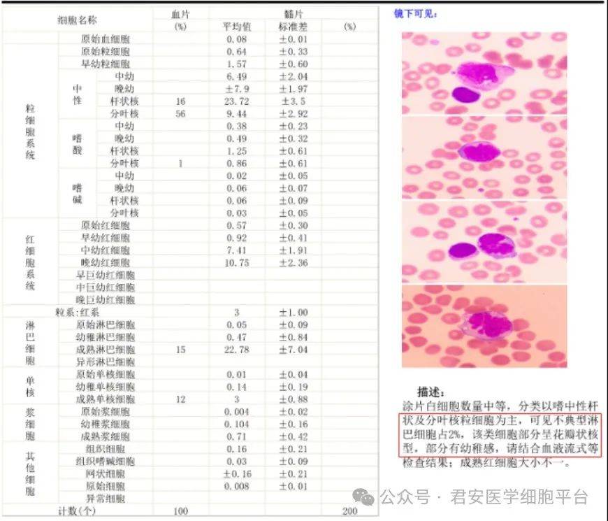 外周血涂片报告图片