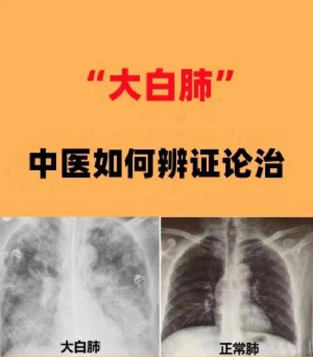 大白肺，看看中医大师如何治疗