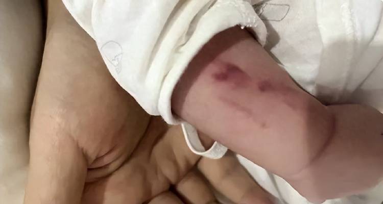 广西一男婴在月子中心被照料20天:身上2处骨折,育婴室监控无法查看 广西一男婴在月子中心被照料20天:身上2处骨折,育婴室监控无法查看