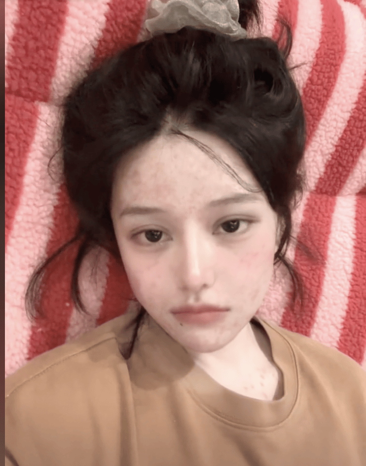 她自曝患癌！“决定放弃化疗”，多位名人因此去世，发现就是中晚期…