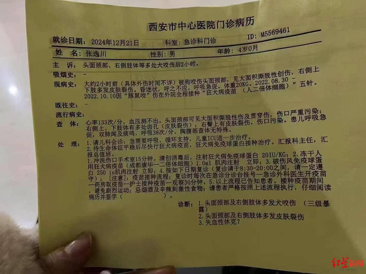 西安4岁男童遭恶犬袭击,致脸部大面积创伤,目前仍在ICU昏迷 警方已在调查犬只来源 西安4岁男童遭恶犬袭击,致脸部大面积创伤,目前仍在ICU昏迷 警方已在调查犬只来源