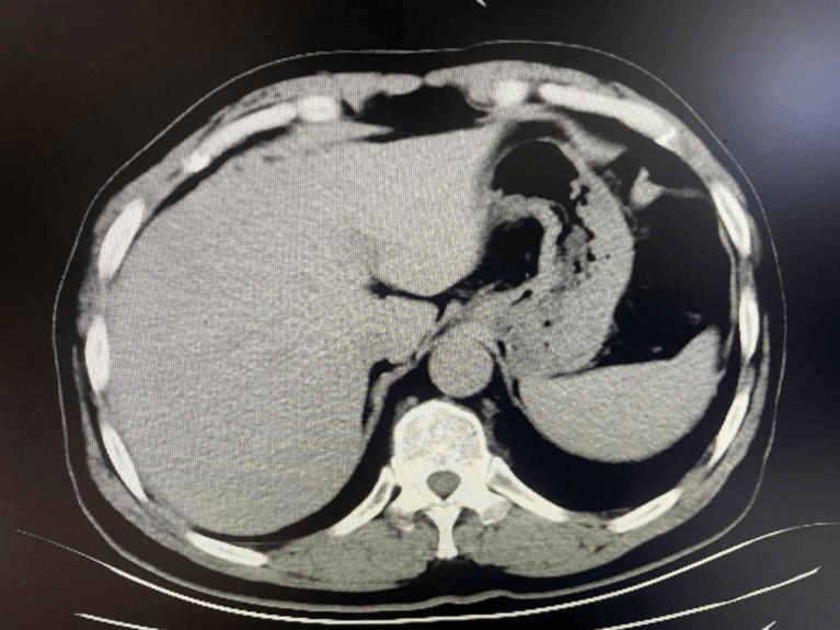 医生,你为什么不给我做这个ct检查?