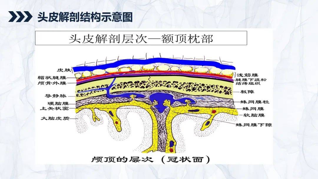 一例头皮撕脱伤患者护理查房