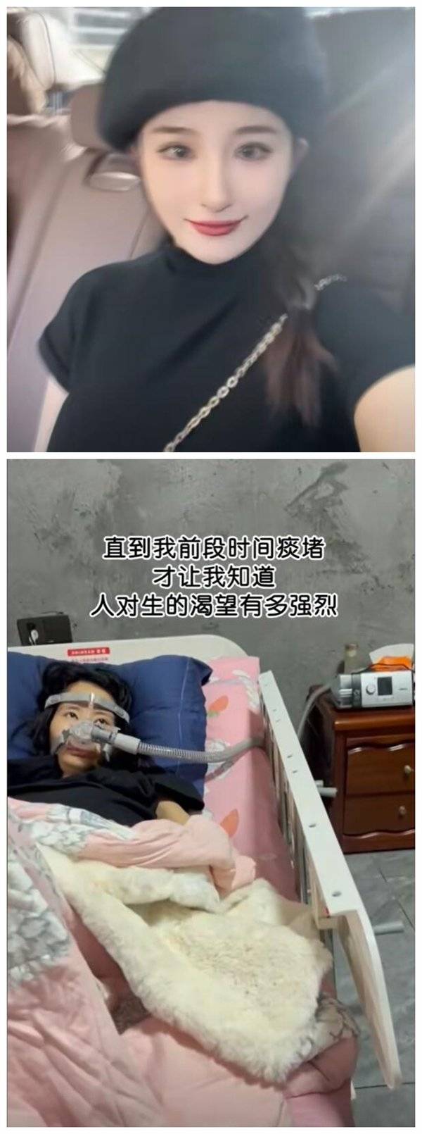 女生確診漸凍癥容貌巨變 母親回應：剛從ICU出來 一清醒就想做視頻