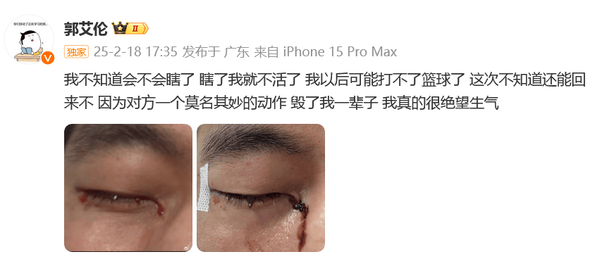 热搜第一：郭艾伦被队员手指插进眼珠缝40多针，“以后可能打不了篮球”
