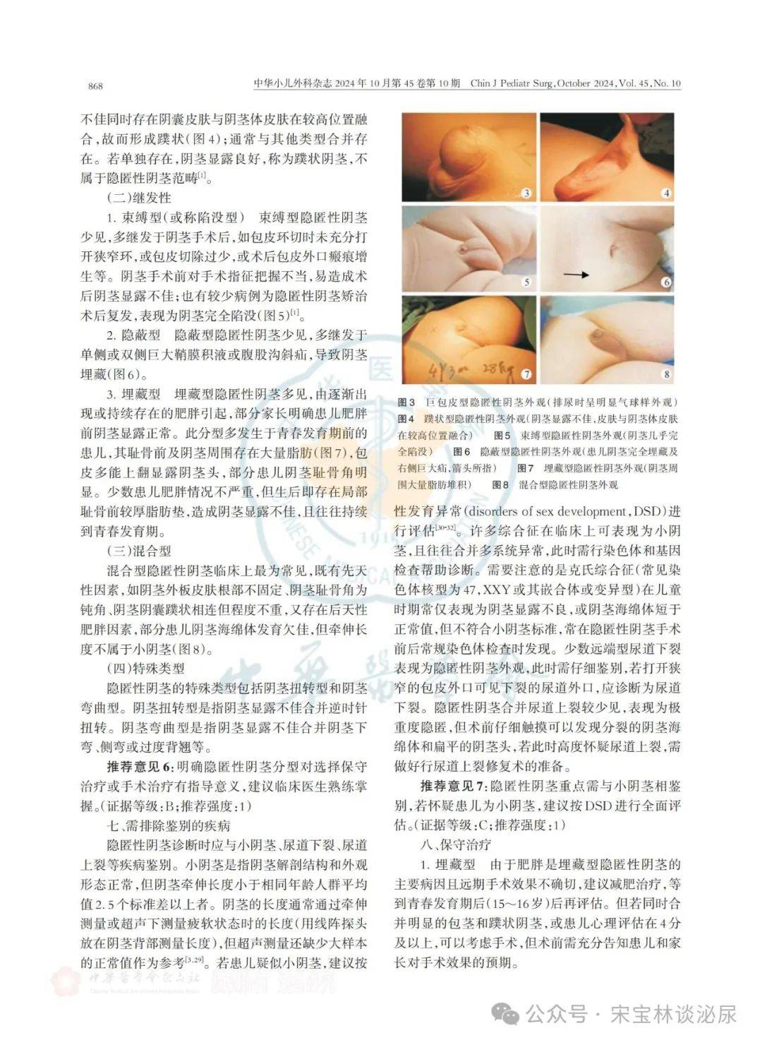 中国小儿隐匿性阴茎临床处理专家共识