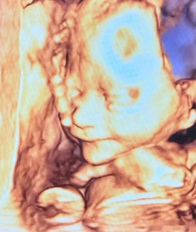 包贝尔老婆晒b超照,包文婧孕8个月肚子又大又圆,宝宝颜值好高