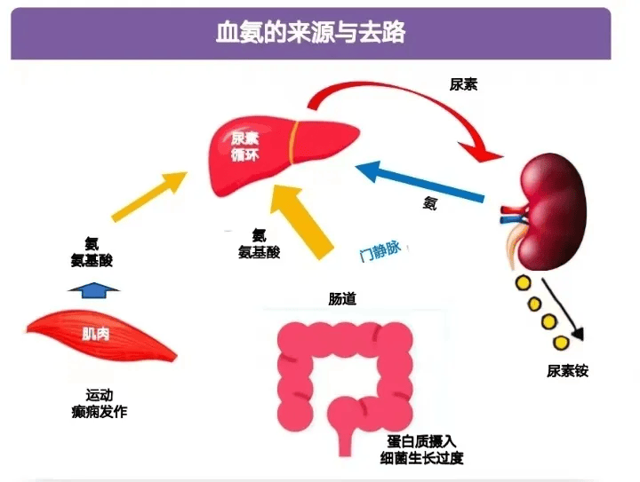 血氨升高一定会引发"肝性脑病"吗?听听医生怎么说!