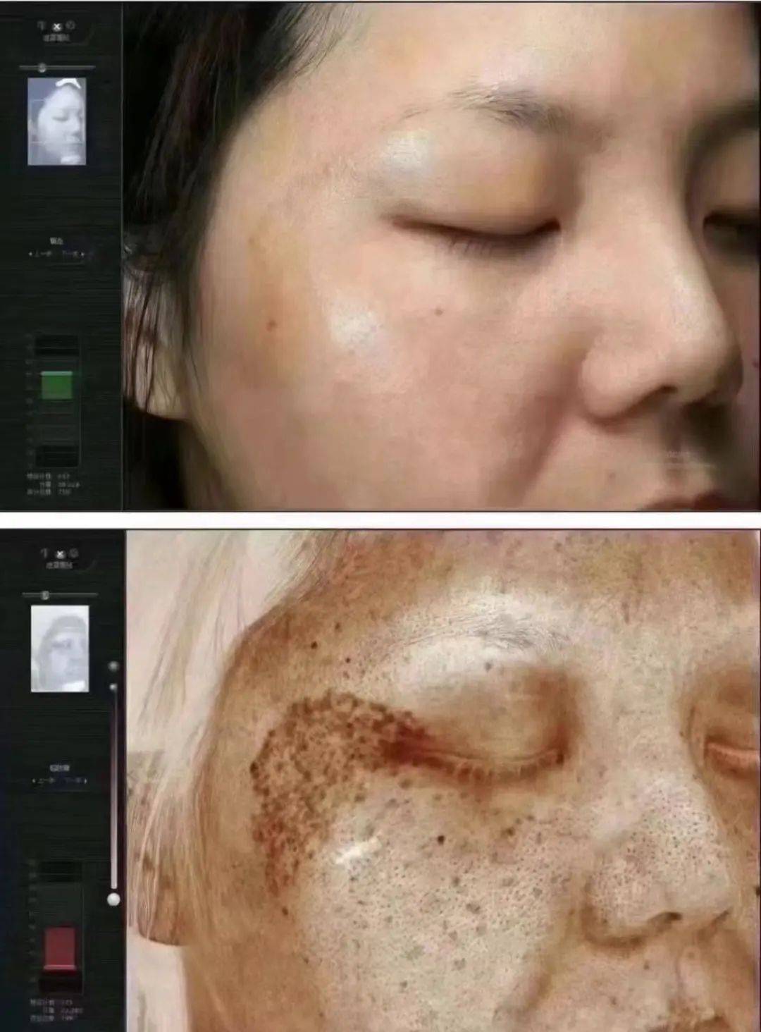 无论你色斑有多深试试这个老国货70岁以内都有救