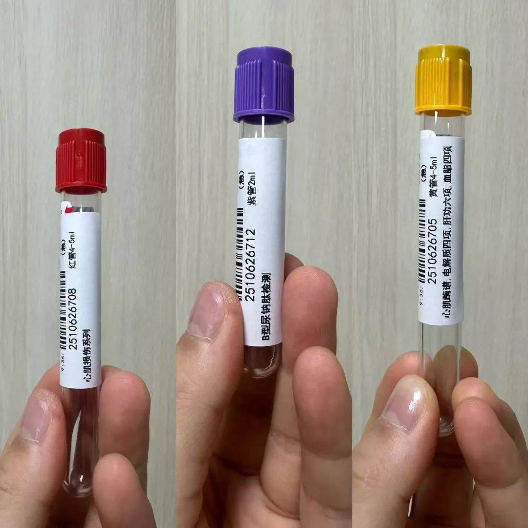 抽血暗藏玄机?医生揭秘:这14管血如何预判心梗,心衰风险