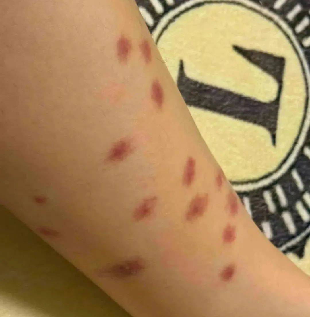 蠓虫,俗称"小咬"