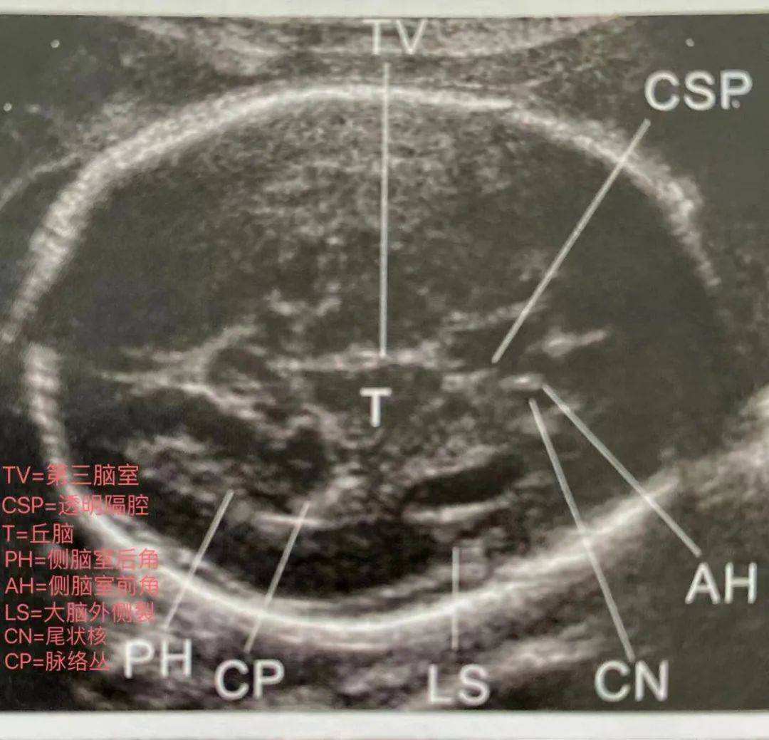不懂就问四维彩超报告怎么看9大关键数据解读来啦孕妈们请速速收藏