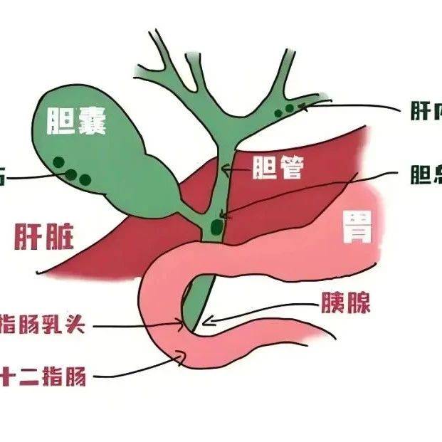 胆结石?疼or不疼?_胆管_体检_症状
