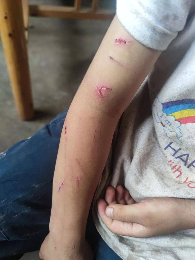 13岁男孩曝多次遭父亲殴打,脑袋被割开,身上骨折,当地警方介入