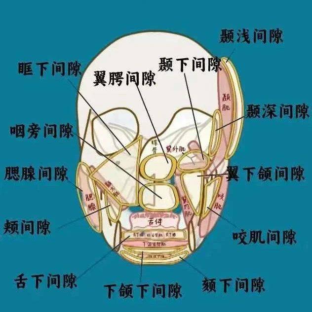 口腔颌面部间隙感染——口腔科护士给患者的实用指南_治疗_严重_护理