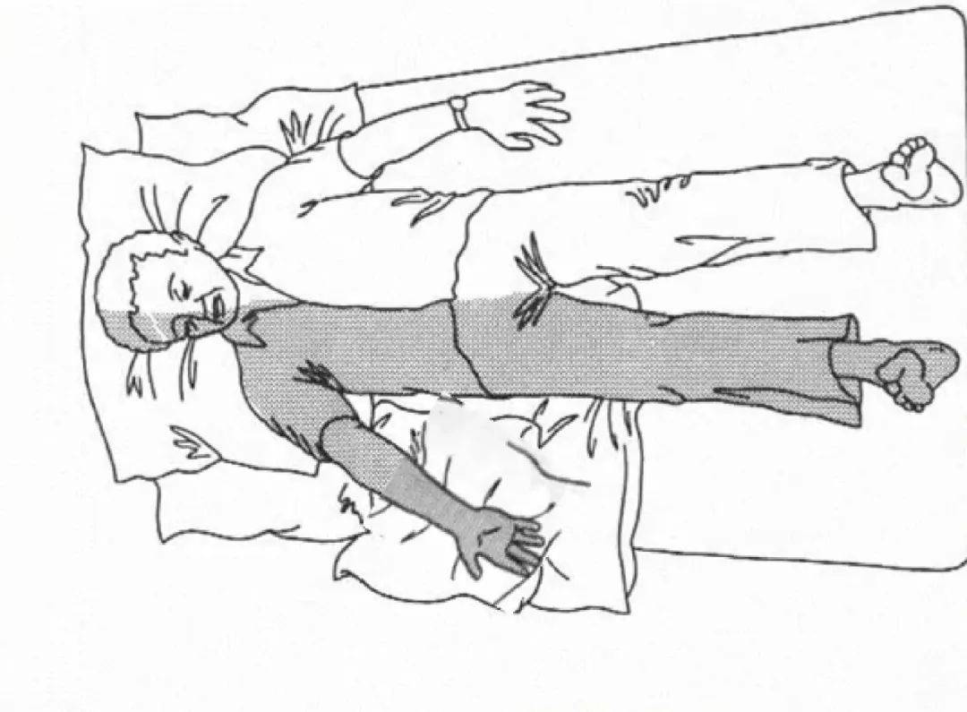 小姿势大作用偏瘫后良肢位的摆放贤医健康说