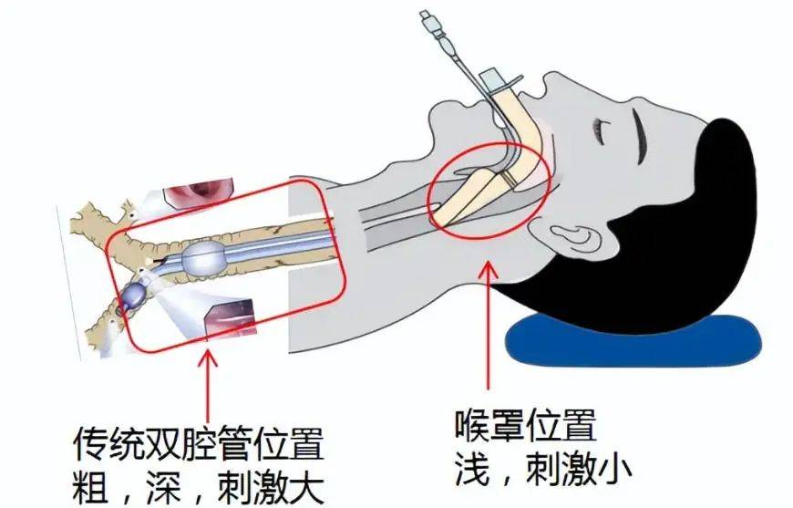 填补空白！市人民医院跨入“超微创”时代！