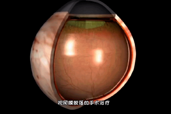 “杀伤力”惊人！击穿眉骨、扎穿手指……有明星也曾中招！很多深圳人也爱玩