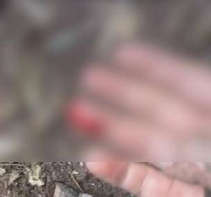 四川男子采蘑菇被毒蛇咬伤拦车就医，网友质疑不紧急处理反而拍视频？当事人回应