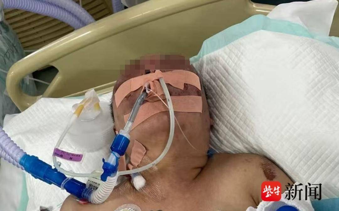 女子遭前夫殴打致直肠破裂进ICU，警方回应：涉事者已被刑事拘留